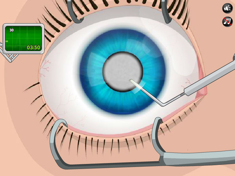 ¿Quieres Ser Cirujano De Ojos Por Un Momento? - Blog De Ojos - Innova ...